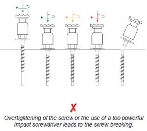 concrete screws